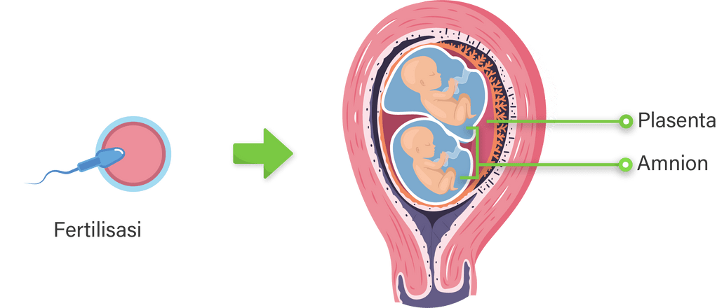 Perhatikan Gambar Proses Kehamilan Berikut Ini